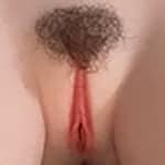 Implanted