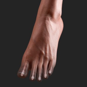 Dedo de pie con cable